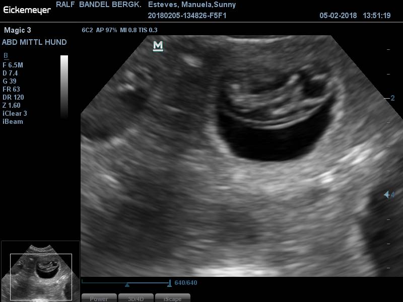 201802051351200002ABD